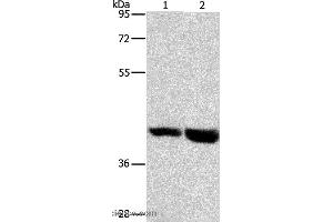 Western blot analysis of Mouse heart and liver tissue, using GPR182 Polyclonal Antibody at dilution of 1:1000 (G Protein-Coupled Receptor 182 抗体)