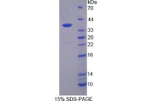 Image no. 1 for Interleukin 12 beta (IL12B) (AA 23-329) protein (His tag) (ABIN6236549) (IL12B Protein (AA 23-329) (His tag))