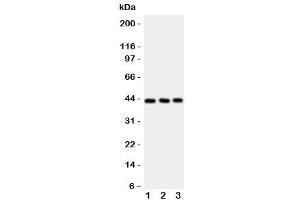 Western blot testing of CCR9 antibody and Lane 1:  Jurkat (CCR9 抗体  (N-Term))