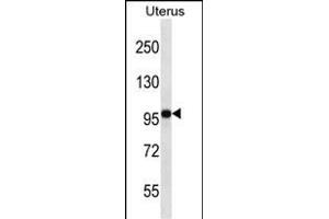 FGD4 Antibody (N-term) (ABIN656907 and ABIN2846104) western blot analysis in human normal Uterus tissue lysates (35 μg/lane). (FGD4 抗体  (N-Term))