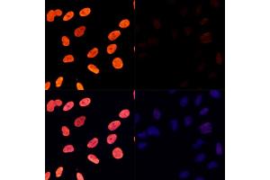 Immunofluorescence analysis of U-2 OS cells treated by TSA (upper left) and untreated U-2 OS cells (upper right) using Acetyl-Histone H3-K27 Rabbit pAb (red, ABIN7267670) at dilution of 1:100.