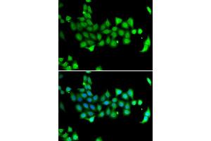 Immunofluorescence analysis of A549 cells using HSPA14 antibody. (HSPA14 抗体  (AA 240-509))