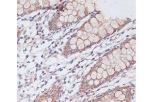Immunohistochemistry of paraffin-embedded Human colon using MBTPS1 Polyclonal Antibody at dilution of 1:100 (40x lens). (MBTPS1 抗体)