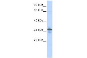RPIA antibody used at 1 ug/ml to detect target protein. (Ribose 5-Phosphate Isomerase A (RPIA) 抗体)