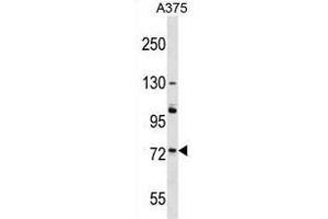 ACOX2 Antibody (N-term) western blot analysis in A375 cell line lysates (35 µg/lane).