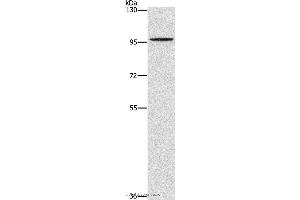 Western blot analysis of A172 cell, using PDE6C Polyclonal Antibody at dilution of 1:1400 (PDE6C 抗体)