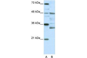 WB Suggested Anti-HTLF Antibody Titration:  0. (FOXN2 抗体  (N-Term))