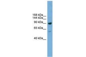 Image no. 1 for anti-DEAD (Asp-Glu-Ala-Asp) Box Polypeptide 54 (DDX54) (AA 751-800) antibody (ABIN6744608) (DDX54 抗体  (AA 751-800))