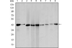 Western blot analysis using ACTA2 mouse mAb against Hela (1), Jurkta (2), HepG2 (3), MCF-7 (4), A431 (5), A549 (6), PC-12 (7), NIH/3T3 (8) and Cos7 (9) cell lysate. (Smooth Muscle Actin 抗体)