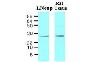 Cell lysates of LNcap (30ug) and Rat testis (30ug) were resolved by SDS-PAGE, transferred to NC membrane and probed with anti-human STEAP1 (1:500). (STEAP1 抗体  (AA 1-70))