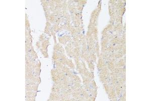 Immunohistochemistry of paraffin-embedded mouse heart using BMPR2 antibody (ABIN7265906) at dilution of 1:100 (40x lens). (BMPR2 抗体  (AA 27-150))