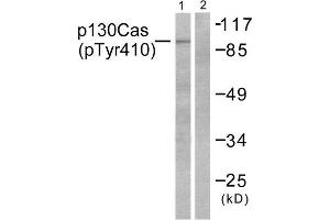 Western Blotting (WB) image for anti-Breast Cancer Anti-Estrogen Resistance 1 (BCAR1) (pTyr410) antibody (ABIN1847248) (BCAR1 抗体  (pTyr410))