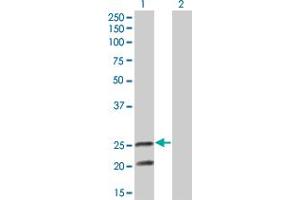 Western Blot analysis of IL6 expression in transfected 293T cell line by IL6 monoclonal antibody (M05), clone 3E8. (IL-6 抗体  (AA 29-212))