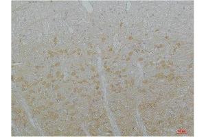 Immunohistochemistry (IHC) image for anti-Calcium Channel, Voltage Dependent, T Type, alpha 1I Subunit (CACNA1I) antibody (ABIN7189150)