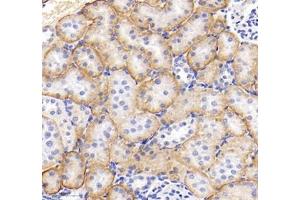 Immunohistochemistry of paraffin embedded rat kidney using MRPS35 (ABIN7074655) at dilution of 1: 400 (300x lens)