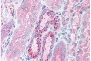Human Kidney (formalin-fixed, paraffin-embedded) stained with TFAM antibody ABIN214152 at 5 ug/ml followed by biotinylated goat anti-rabbit IgG secondary antibody ABIN481713, alkaline phosphatase-streptavidin and chromogen. (TFAM 抗体  (AA 75-124))