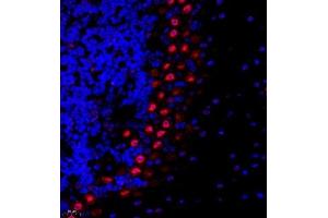 Immunofluorescence of paraffin embedded mouse cerebellum using USP27 (ABIN7076113) at dilution of 1:1500 (400x lens) (USP27X 抗体)