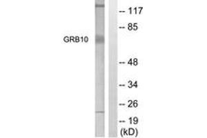 Western Blotting (WB) image for anti-Growth Factor Receptor-Bound Protein 10 (GRB10) (AA 33-82) antibody (ABIN2888873) (GRB10 抗体  (AA 33-82))