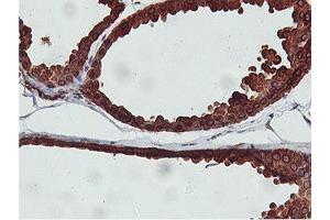 Immunohistochemical staining of paraffin-embedded Human breast tissue using anti-C20orf3 mouse monoclonal antibody. (APMAP 抗体)