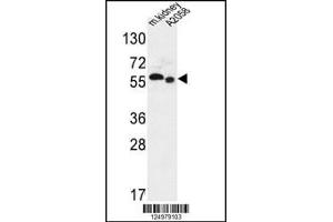 Western Blotting (WB) image for anti-Solute Carrier Family 47, Member 2 (SLC47A2) (AA 125-153), (N-Term) antibody (ABIN5530540)