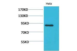Western Blot (WB) analysis of HeLa using Stat4 Polyclonal Antibody. (STAT4 抗体)