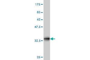 Western Blot detection against Immunogen (34. (TCOF1 抗体  (AA 2-82))