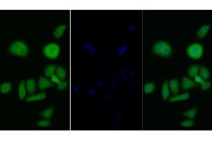 Detection of PIK3Cb in Human Hela cell using Polyclonal Antibody to Phosphoinositide-3-Kinase Catalytic Beta Polypeptide (PIK3Cb) (PIK3CB 抗体  (AA 524-703))