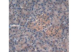 Used in DAB staining on fromalin fixed paraffin- embedded pancreas tissue (EPRS 抗体  (AA 749-956))