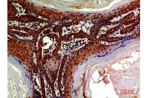 Immunohistochemistry (IHC) image for anti-ADAM Metallopeptidase with thrombospondin Type 1 Motif, 18 (ADAMTS18) antibody (ABIN3188077)