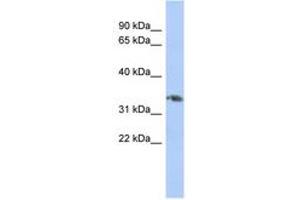 Image no. 1 for anti-Homeobox D10 (HOXD10) (AA 143-192) antibody (ABIN6744410) (HOXD10 抗体  (AA 143-192))