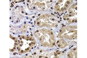 Immunohistochemistry of paraffin-embedded Human kidney using DNAJB6 Polyclonal Antibody at dilution of 1:100 (40x lens). (DNAJB6 抗体)