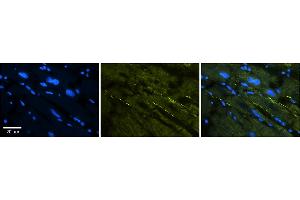 Rabbit Anti-SCN5A Antibody  Catalog Number: ARP34935_P050 Formalin Fixed Paraffin Embedded Tissue: Human Adult heart  Observed Staining: Membrane (stronger than with ARP34934) Primary Antibody Concentration: 1:600 Secondary Antibody: Donkey anti-Rabbit-Cy2/3 Secondary Antibody Concentration: 1:200 Magnification: 20X Exposure Time: 0. (SCN5A 抗体  (C-Term))
