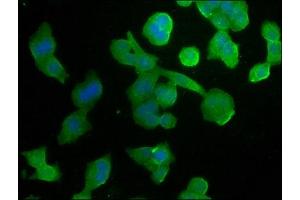 Immunofluorescence staining of PC-3 cells with ABIN7140074 at 1:266, counter-stained with DAPI. (GPR37 抗体  (AA 114-133))