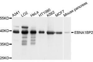 Western blot analysis of extract of various cells, using EBNA1BP2 antibody. (EBNA1BP2 抗体)
