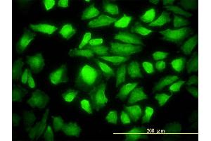 Immunofluorescence of monoclonal antibody to DNAJB6 on HeLa cell. (DNAJB6 抗体  (AA 1-241))