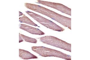 (ABIN6242693 and ABIN6578667) staining Vinculin in mouse skeletal muscle tissue sections by Immunohistochemistry (IHC-P - paraformaldehyde-fixed, paraffin-embedded sections). (Vinculin 抗体  (AA 634-668))