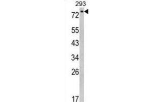 Western Blotting (WB) image for anti-EPS8-Like 3 (EPS8L3) antibody (ABIN3002873) (EPS8-Like 3 抗体)