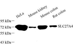 Western Blotting (WB) image for anti-Solute Carrier Family 27 (Fatty Acid Transporter), Member 4 (SLC27A4) antibody (ABIN7075671)