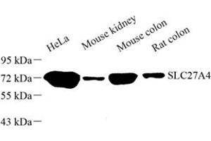 SLC27A4 抗体