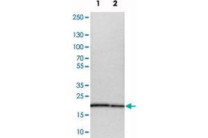 Western blot analysis of cell lysates with MPDU1 polyclonal antibody  at 1:250-1:500 dilution.