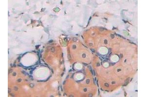 Detection of PANX1 in Rat Skin Tissue using Polyclonal Antibody to Pannexin 1 (PANX1)