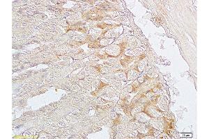 Formalin-fixed and paraffin embedded mouse stomach labeled with Anti-SGCB/SGC Polyclonal Antibody, Unconjugated  at 1:200 followed by conjugation to the secondary antibody and DAB staining. (SGCB 抗体  (AA 165-260))