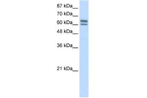 Western Blotting (WB) image for anti-Nucleus Accumbens Associated 1, BEN and BTB (POZ) Domain Containing (NACC1) (C-Term) antibody (ABIN2778437)
