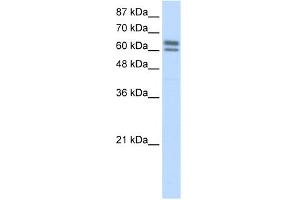 WB Suggested Anti-BTBD14B Antibody Titration:  5. (NAC1 抗体  (C-Term))