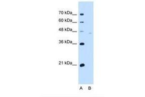 Image no. 2 for anti-Neuroplastin (NPTN) (AA 201-250) antibody (ABIN321178) (NPTN 抗体  (AA 201-250))