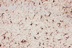 Anti-GFAP Picoband antibody,  IHC(P): Mouse Brain Tissue (GFAP 抗体  (AA 93-432))