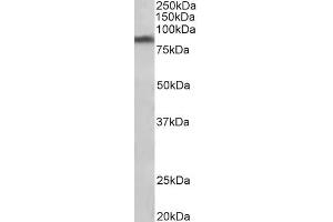 Western Blotting (WB) image for anti-Solute Carrier Family 6 (Neurotransmitter Transporter, Dopamine), Member 3 (SLC6A3) (Internal Region) antibody (ABIN940564)