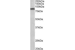 ABIN940564 (1µg/ml) staining of Human Substantia nigra lysate (35µg protein in RIPA buffer). (SLC6A3 抗体  (Internal Region))