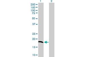 Western Blotting (WB) image for anti-NADH Dehydrogenase (Ubiquinone) 1 alpha Subcomplex, 8, 19kDa (NDUFA8) (AA 1-172) antibody (ABIN518230)