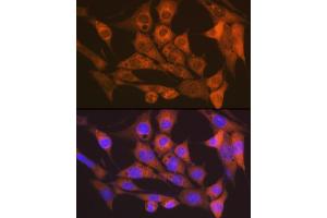 Immunofluorescence analysis of NIH-3T3 cells using CaMKII delta Rabbit mAb (ABIN7266019) at dilution of 1:100 (40x lens). (CAMK2D 抗体)